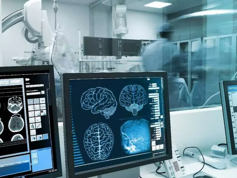 Enfermedad de Huntington - síntomas, diagnóstico, tratamiento