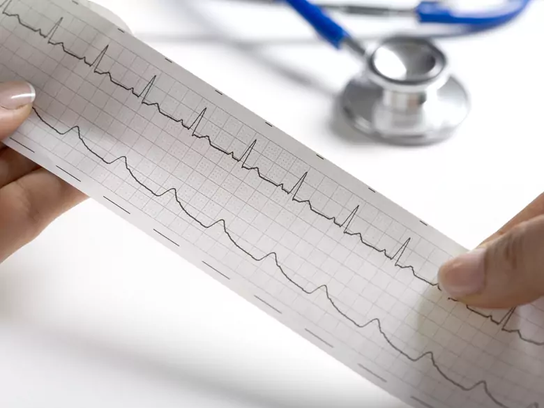 Insuficiencia cardíaca