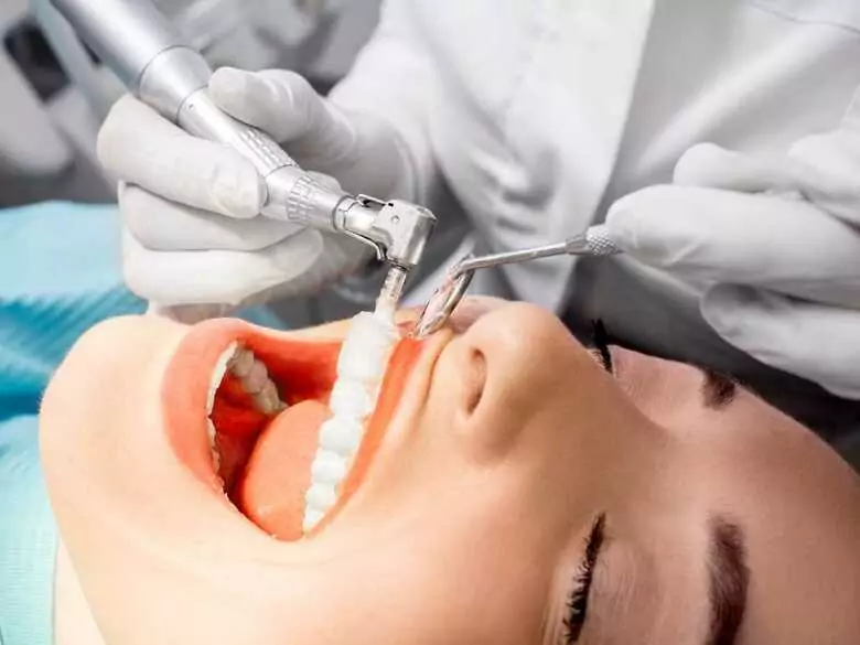 Barnizado dental
