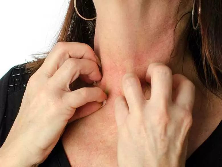 ¿Por qué pica la piel?