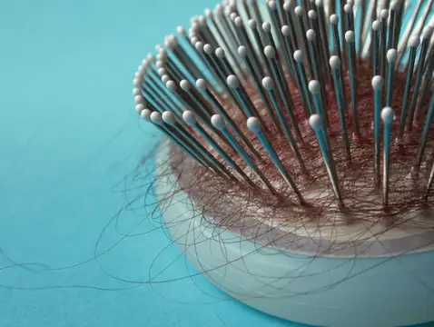 ¿Se me caerá el pelo después de la quimioterapia?