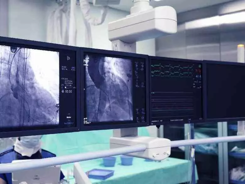 ¿Cuáles son los beneficios de la revascularización coronaria?