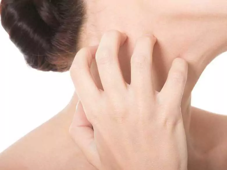 Dermatitis atópica: ¿cómo tratarla?