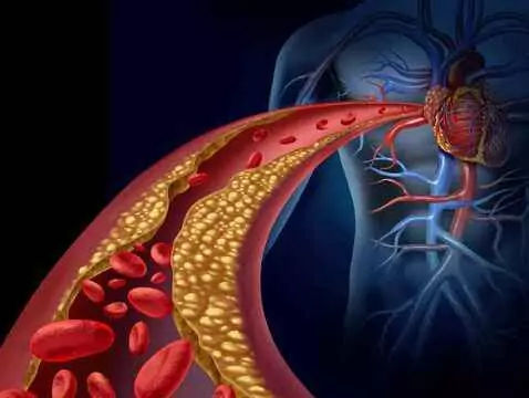 ¿En qué se diferencian las arterias de las venas?