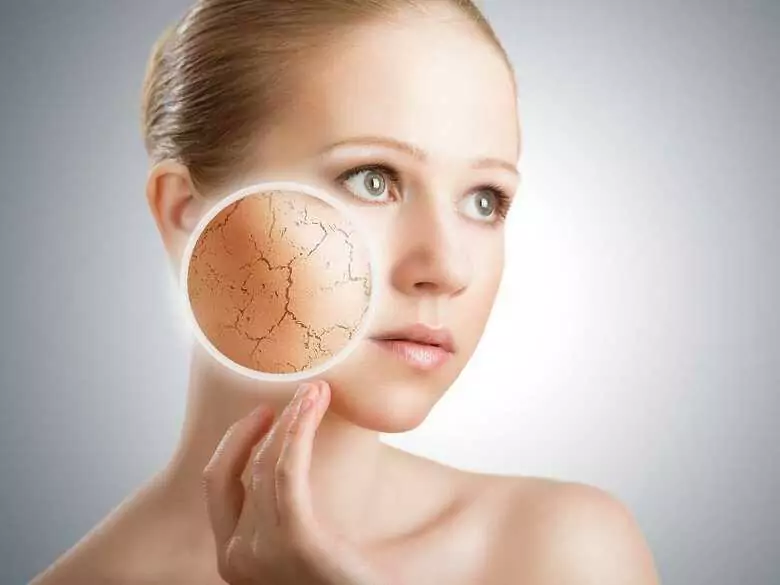 ¿Influye el estado psicológico en las afecciones dermatológicas?