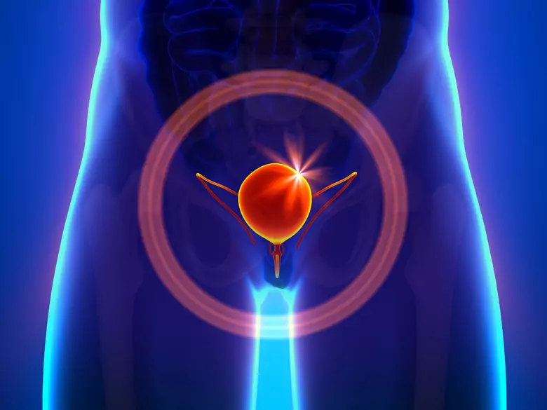 ¿Cuál es una dieta sana para las personas con problemas del tracto urinario?