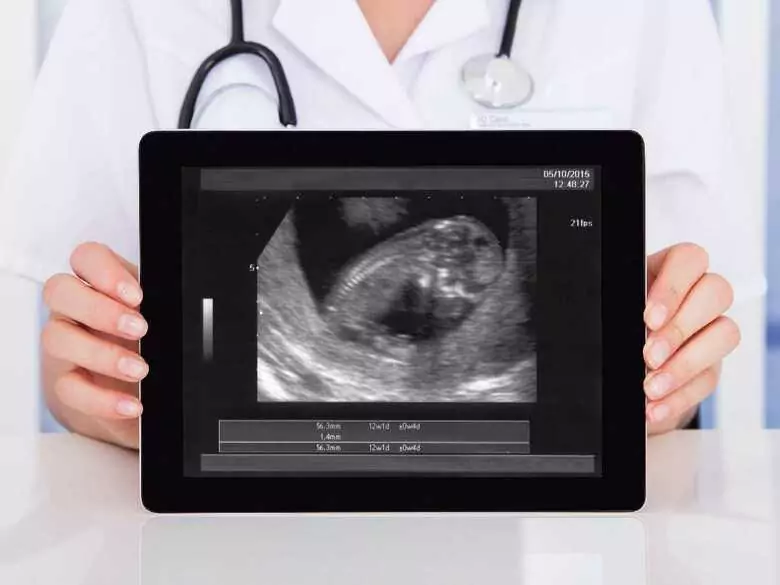 Embarazo ectópico: ¿qué es y cuáles son sus causas?