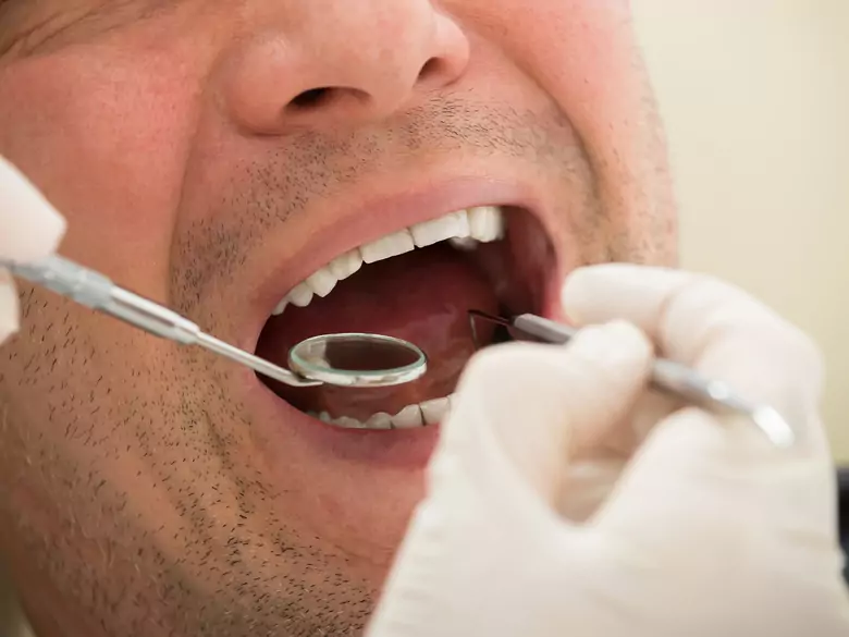 Tratamiento dental sin taladro