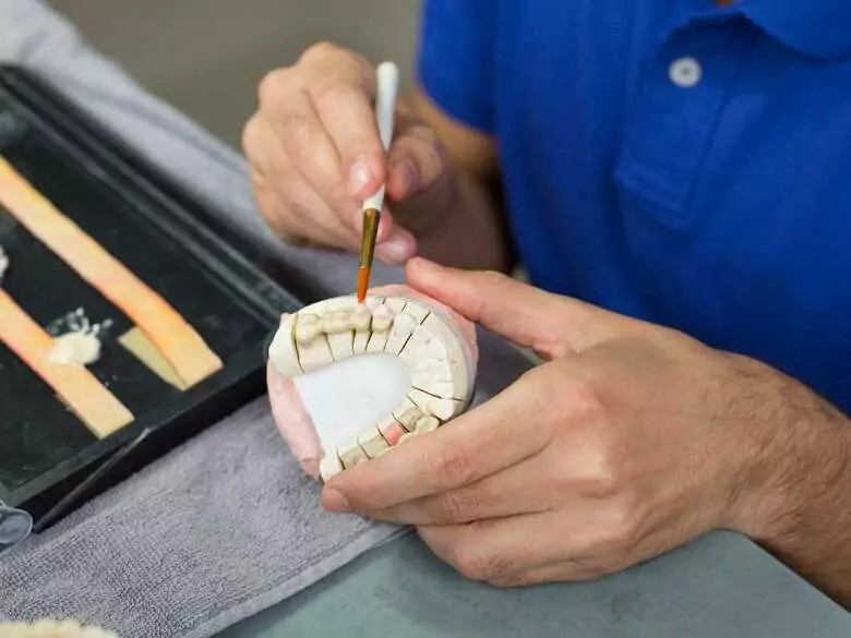 Encaje o carilla: ¿qué elegir?