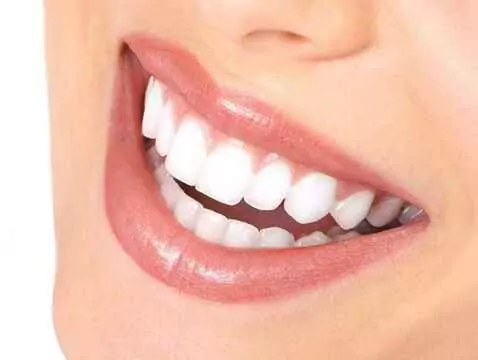Caries