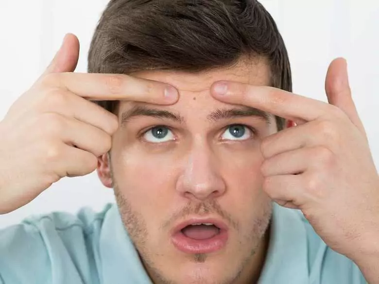 Emolientes para el acné adulto