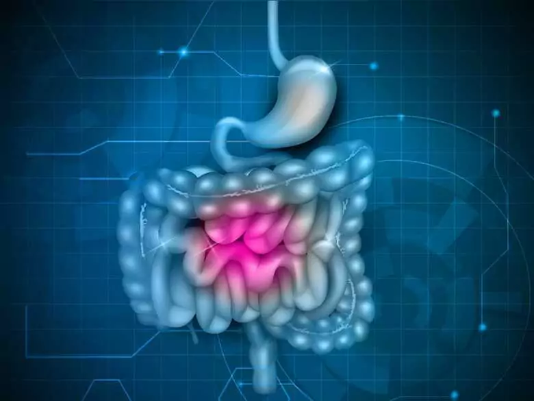 IBP y resultados del tratamiento del cáncer colorrectal