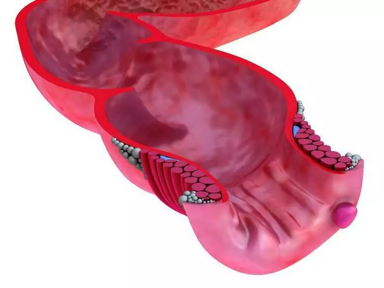 Formación y desarrollo de trombos - trombosis venosa profunda